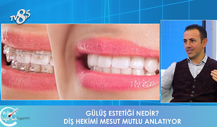Gülüş Tasarımı